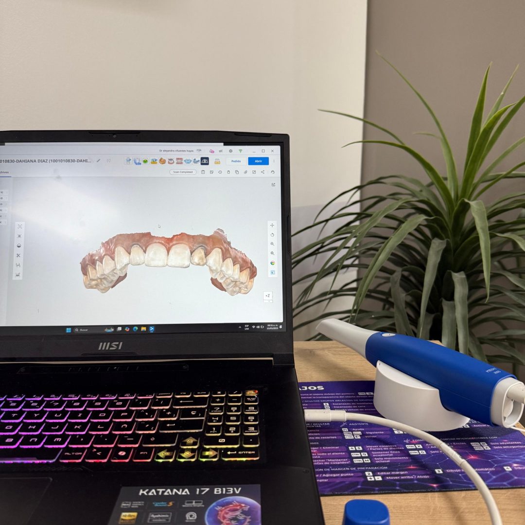 escaner intraoral 2